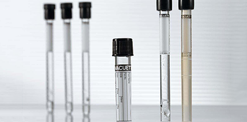 血沉检查的意义重大,临床表明有这3大好处