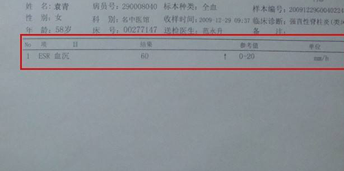 血沉是什么?相关释义与血沉正常值一览