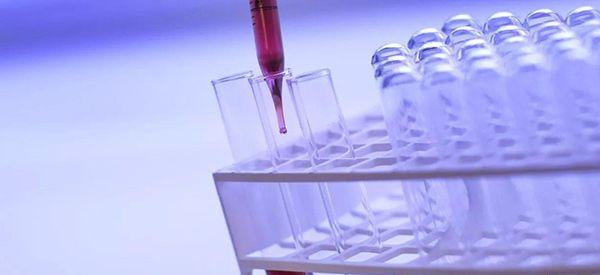 第一次产检验血常规要不要空腹？