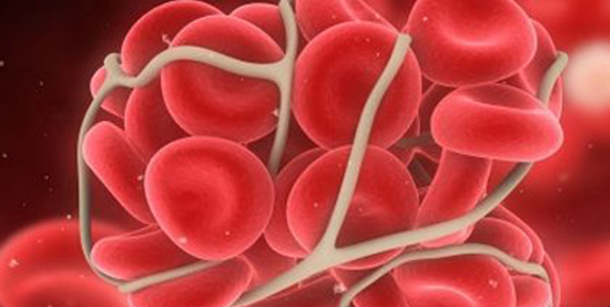 铁蛋白和转铁蛋白有区别!两者的作用与临床意义均不同