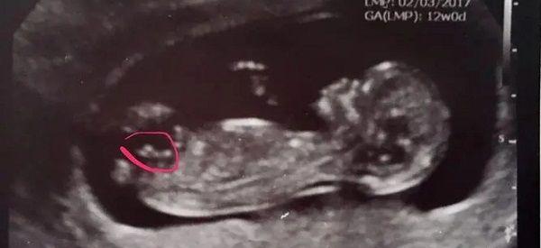 nub点看男女的诀窍是什么准不准？