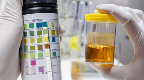 解读2种男性霉菌检查方法，注意涂片无污染可避免假阳性