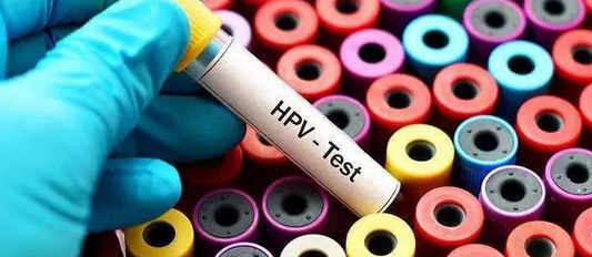 孕检常规检查项目里有hpv这一项吗？