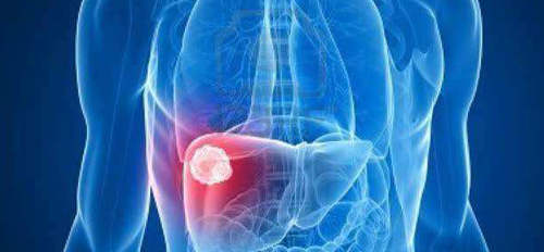 如何快速了解乙肝五项指标,想要看懂只需了解3点即可