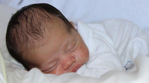 婴儿湿疹对宝宝的影响不可忽视，5大危害并非谣言