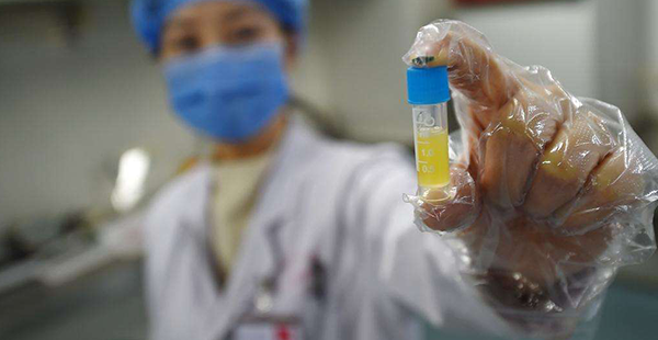 走进中信湘雅精子库，3分钟了解精子的来源！