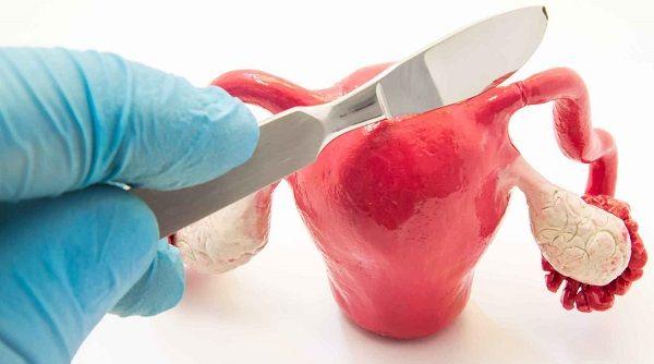 4大弊端告诉你：子宫腺肌症万不得已切勿切除子宫