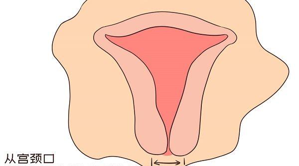 深入讲解宫颈扩张术：子宫粘连女性的福音