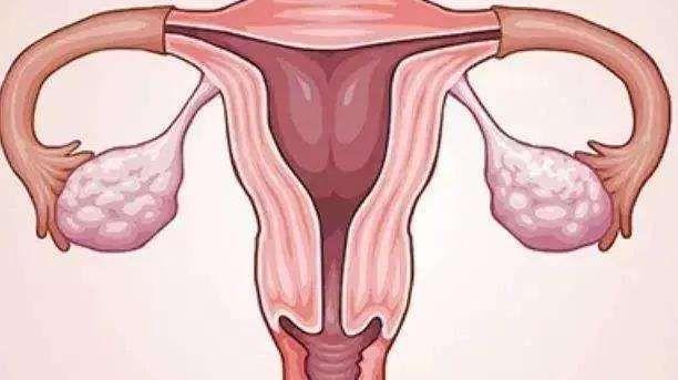 子宫摘除手术过程需要多久时间？