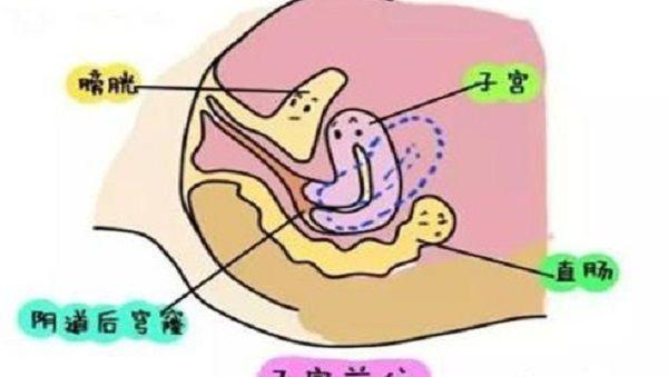 准备怀孕是子宫前位好还是子宫后位好？哪个受孕率高？