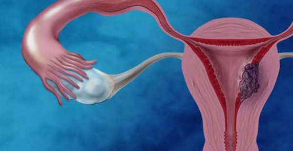 划重点！2分钟带你了解什么是子宫内膜厚