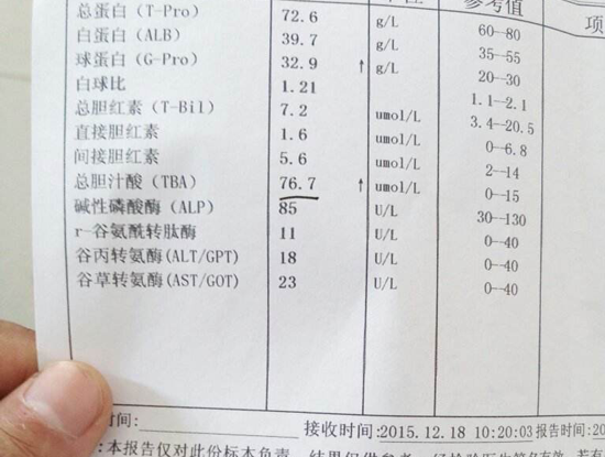 助消化促吸收!胆汁酸的功能和作用其实还有这些
