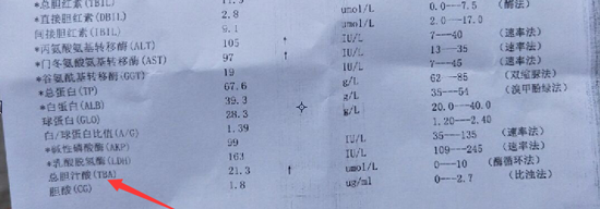 总胆汁酸指标偏高不担心,了解造成原因才能对症治疗
