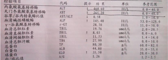 总胆汁酸是什么?反映肝脏功能情况的重要指标