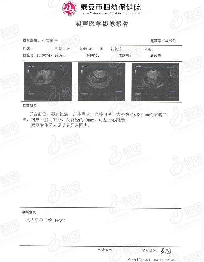 有图有真相！49岁高龄试管婴儿怀满90天