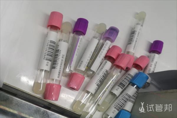 涿州市医院试管婴儿一次成功，过程很简单！