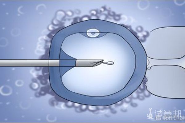 男同二代试管婴儿经历分享