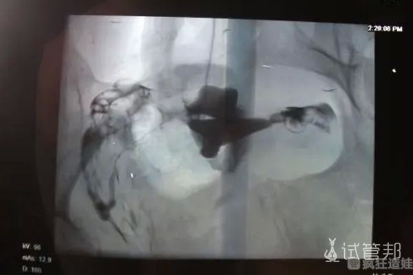 漯河市中心医院第二代试管婴儿好孕，女神节最好的礼物