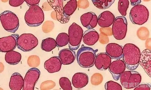 甲胎蛋白偏高是什么情况？做第三代试管婴儿甲胎蛋白高正常吗？