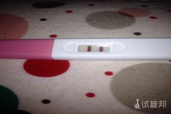 青岛大学附属医院试管婴儿成功，分享这5大关键点