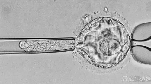 体外受精胚胎移植费用多少？冷冻受精胚胎移植是不是很贵？