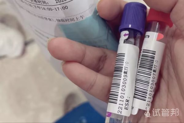 桂林市妇幼保健院试管婴儿养囊结果出来了！