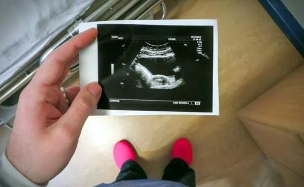 经历整整六个试管周期，打了几百针，最终获得可爱的女儿