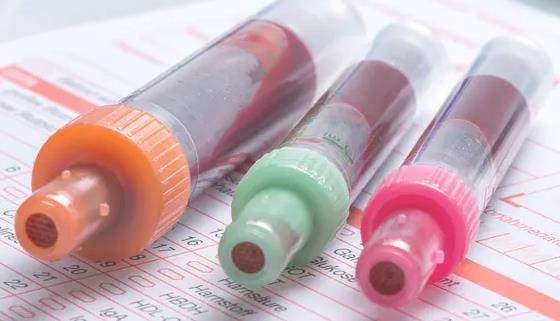 做试管取卵前女方要天天抽血吗?喜孕帮来细说