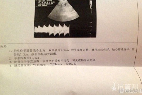 结婚3年一直没怀上，35岁高龄第三代试管婴儿如愿好孕！