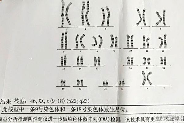 在宁夏妇幼第二代试管婴儿二促一移,宫内单胎好孕