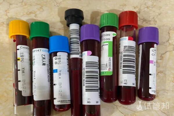 复旦大学附属中山医院试管婴儿前期检查注意事项