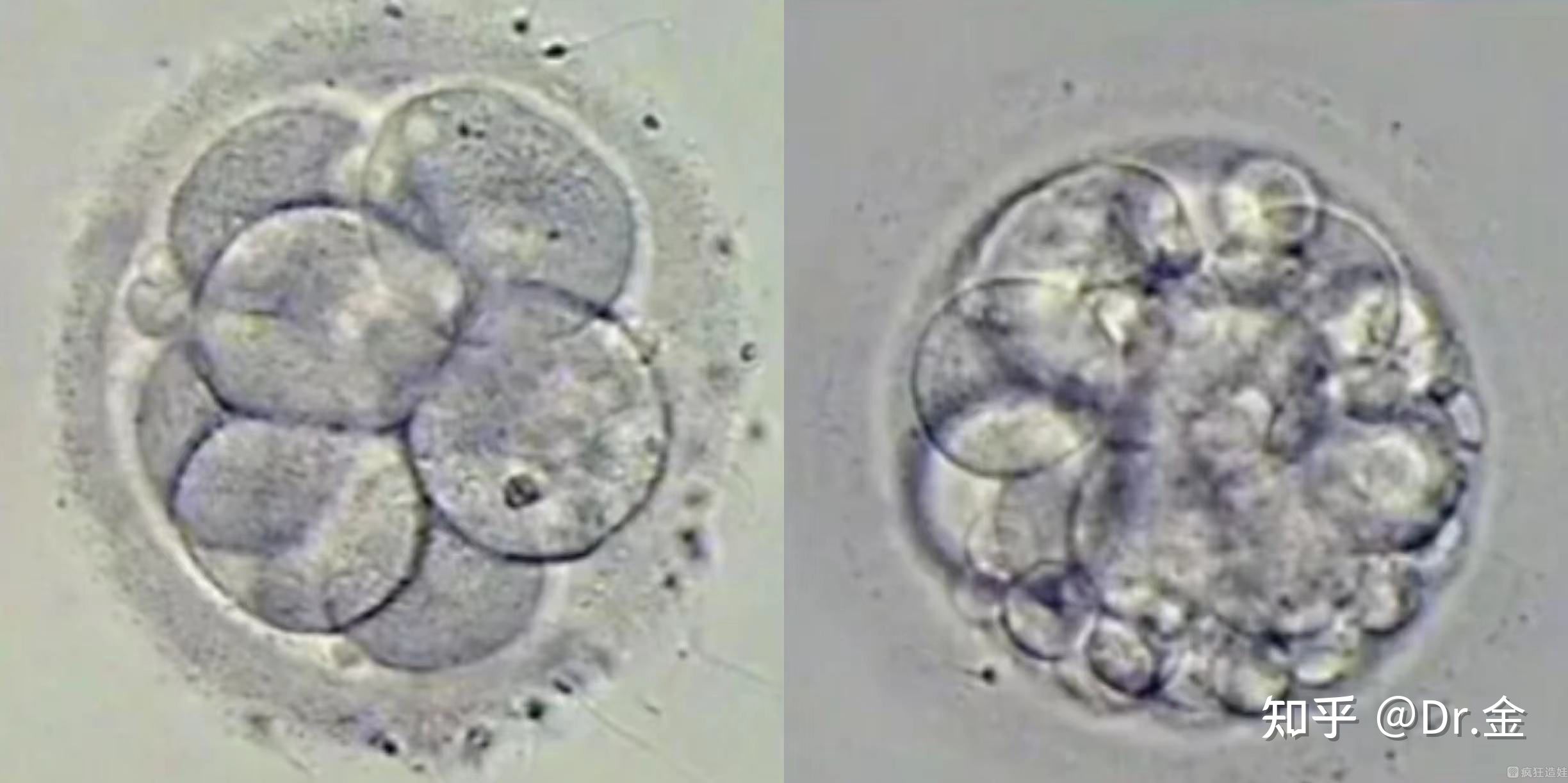 供卵三代试管婴儿反复移植失败的「底层逻辑」，你搞懂了吗？