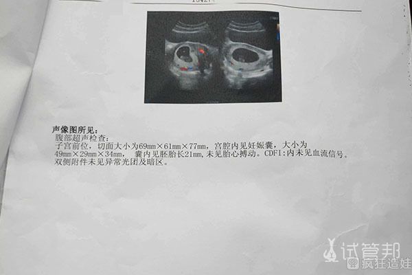 35岁在无锡妇幼保健院3次第三代试管婴儿都失败了，压力好大