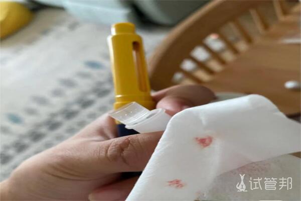 大连市妇女儿童医疗中心试管婴儿：促排取卵注意事项