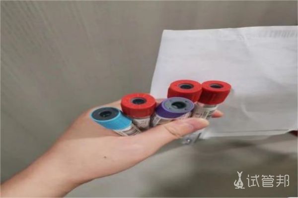 35岁老阿姨的第二代试管婴儿之路笔记，前期检查经历分享