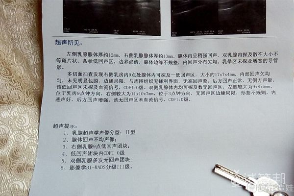 试管二促一移，终究还是第二代试管婴儿移植失败