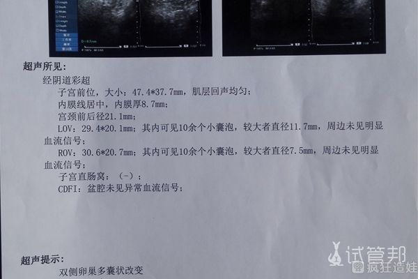 接好孕，深圳市妇幼保健院第二代试管婴儿成功经历