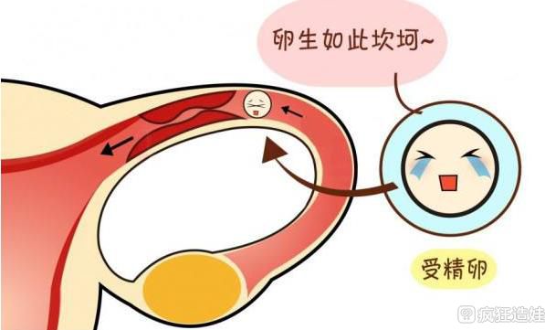 输卵管粘连能做第三代试管婴儿吗？成功机率有多少