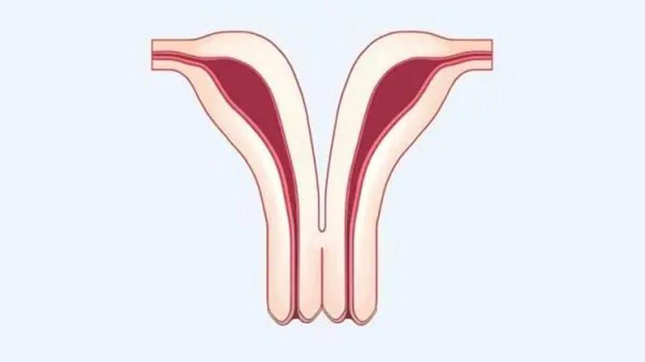 试管单角子宫宫外孕几率大吗？生殖科医生给出了明确的答复