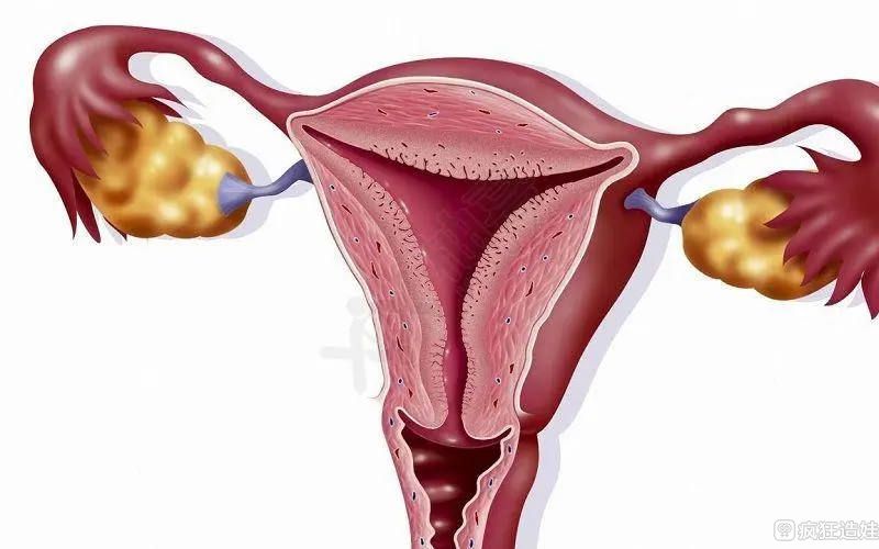 腺肌症能治愈吗？腺肌症适不适合做第三代试管婴儿？