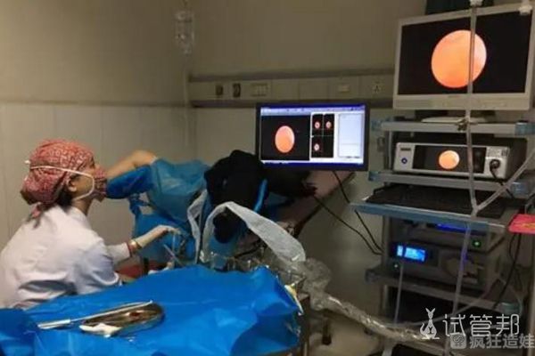 在陕西省人民医院做第二代试管婴儿，进周怎么这么困难？