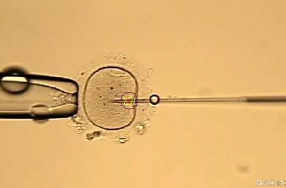 借卵二代试管婴儿医院可以选性别生男孩吗？供卵二代试管婴儿可选男孩吗？