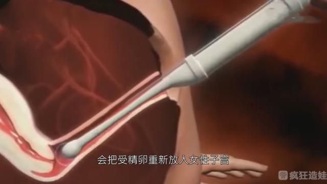 女性做第三代试管婴儿过程很痛苦吗？做第三代试管婴儿详细步骤！