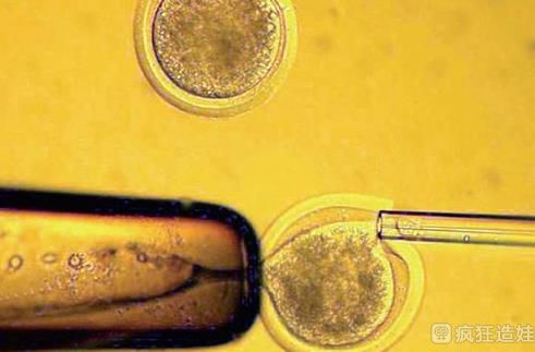 重庆供卵二代试管婴儿包生男孩医院最新榜单？附成功率费用参考？