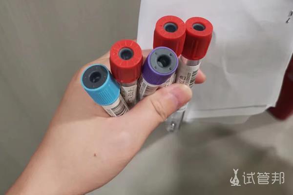 吉安市妇幼保健院试管婴儿检查项目最全分享