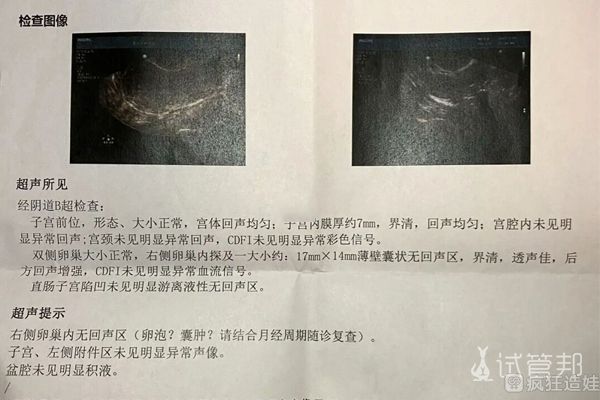 第一次第二代试管婴儿宣告失败，调整心态继续出发