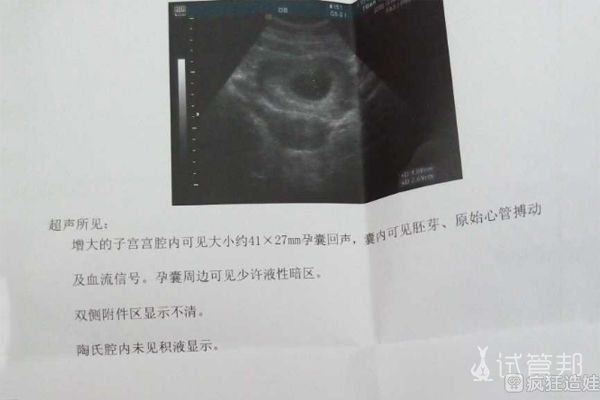 多次流产怀孕难，陕西省人民医院第二代试管婴儿喜得宝宝
