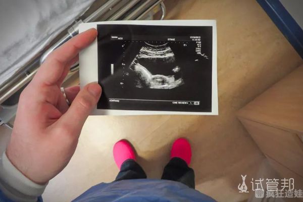 双侧输卵管不同，通过第二代试管婴儿终于成功好孕啦