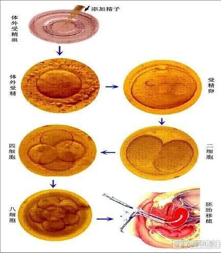 上海公立医院可以直接做供卵三代试管婴儿吗？你想知道的都在这！