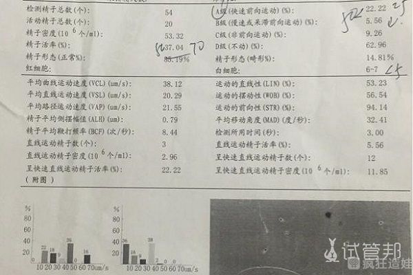 两次人工受精都失败了没怀上，做二代试管婴儿能怀上吗？